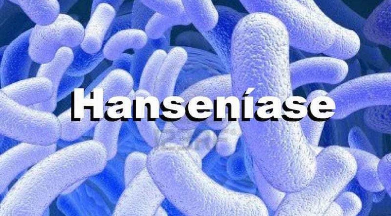 Dia Mundial da Hanseníase: bactéria infecta 30 mil por ano no